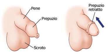 Prepuzio Retratto Prepuzio Retratto