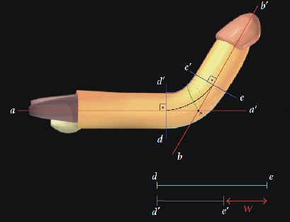 Patologie del pene