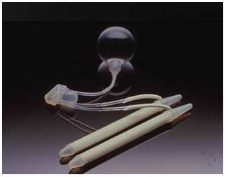 Disfunzione Erettile - protesi peniena idraulica tri-componente